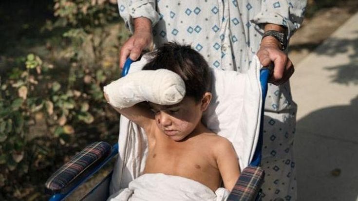 Kabul, l’esplosione vicino ad una scuola: 35 ragazzini feriti soccorsi nell’ospedale di Emergency