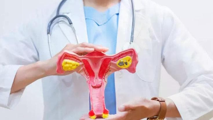 Tumore ovarico, due donne su cinque lo scoprono in emergenza. Ecco i segnali a cui fare attenzione