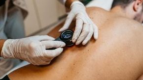 Vaccino per il melanoma a mRNA, positivi i risultati. E Merck e Moderna volano in borsa