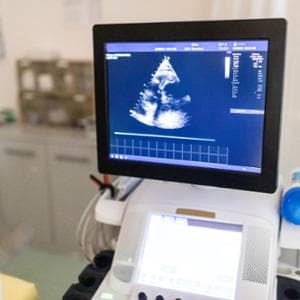Pacemaker senza fili, ecco il doppio check del battito nel cuore di una giovane